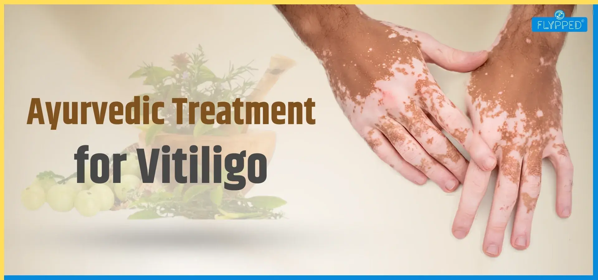 Ayurvedic Treatment for Vitiligo: Benefits, Limitations, Causes, Symptoms & Natural Management